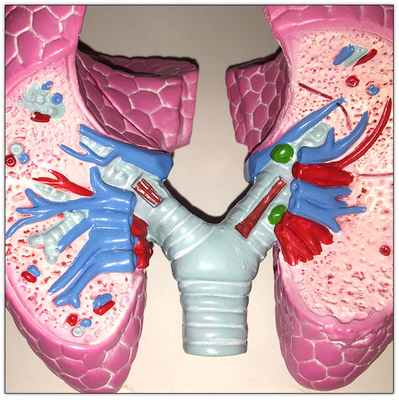 پلاستیک COPD ریه انسان بدن ارگان مدل احتیاط احتیاط 19x13x17cm
